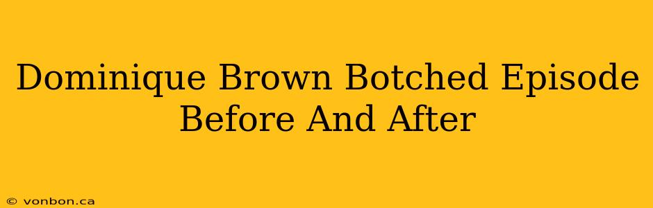 Dominique Brown Botched Episode Before And After