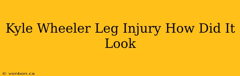 Kyle Wheeler Leg Injury How Did It Look