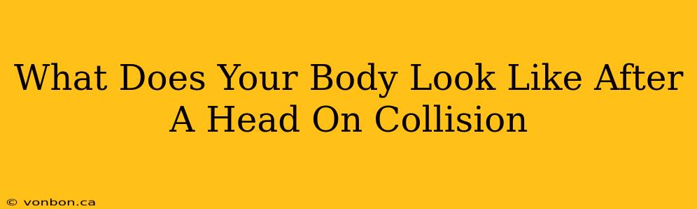 What Does Your Body Look Like After A Head On Collision