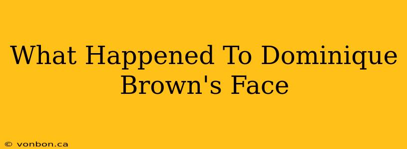 What Happened To Dominique Brown's Face