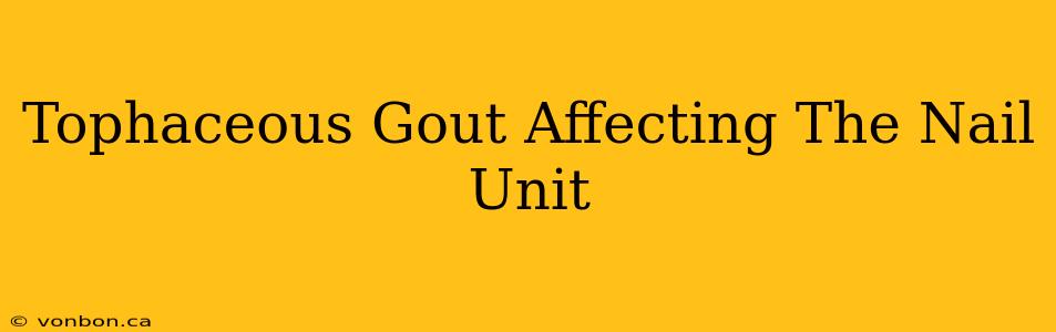 Tophaceous Gout Affecting The Nail Unit